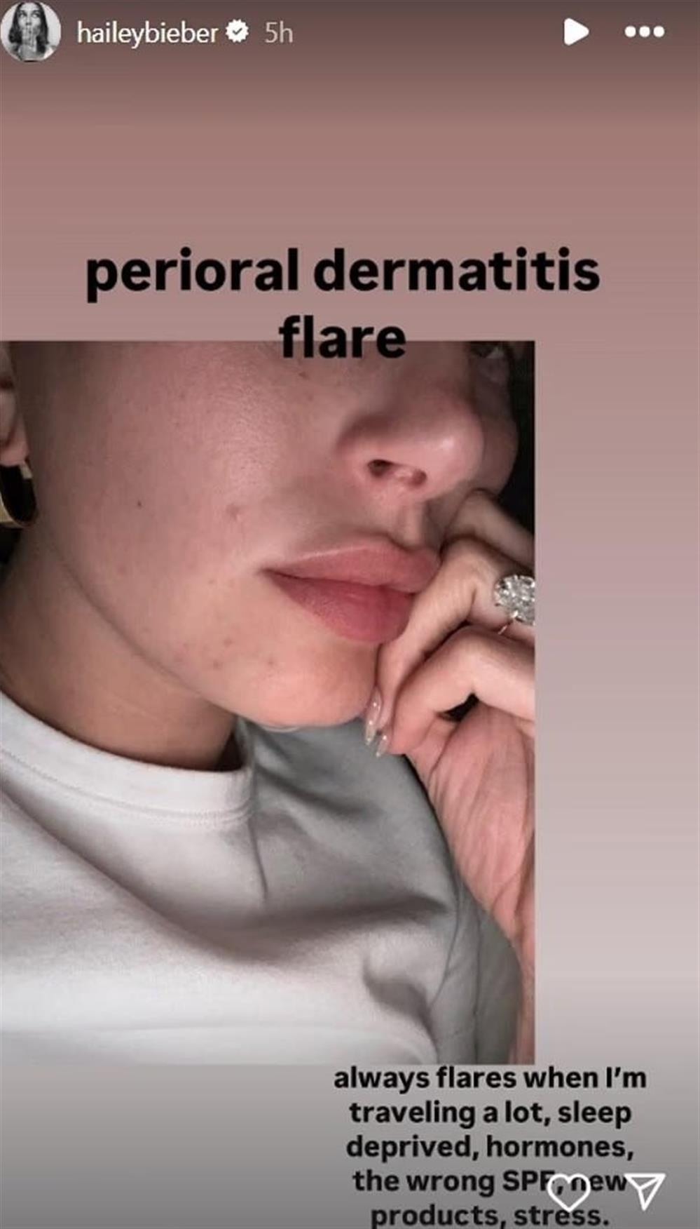 Χέιλι Μπίμπερ Χέιλι Μπίμπερ