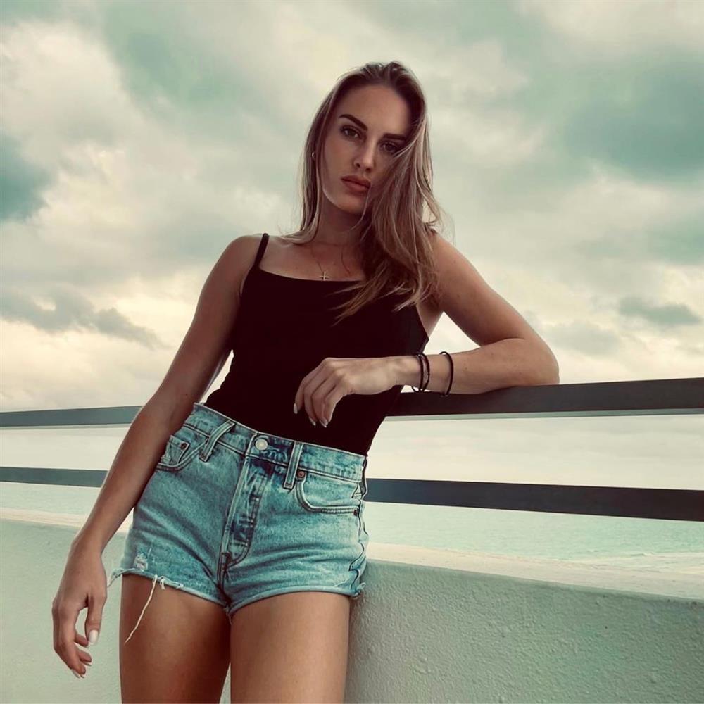 Κατερίνα Δαλάκα: Τραυματίστηκε στο πρόσωπο μετά από ατύχημα στο σπίτι της - "Έσπασα & δόντι και υπέφερα από τον πόνο"