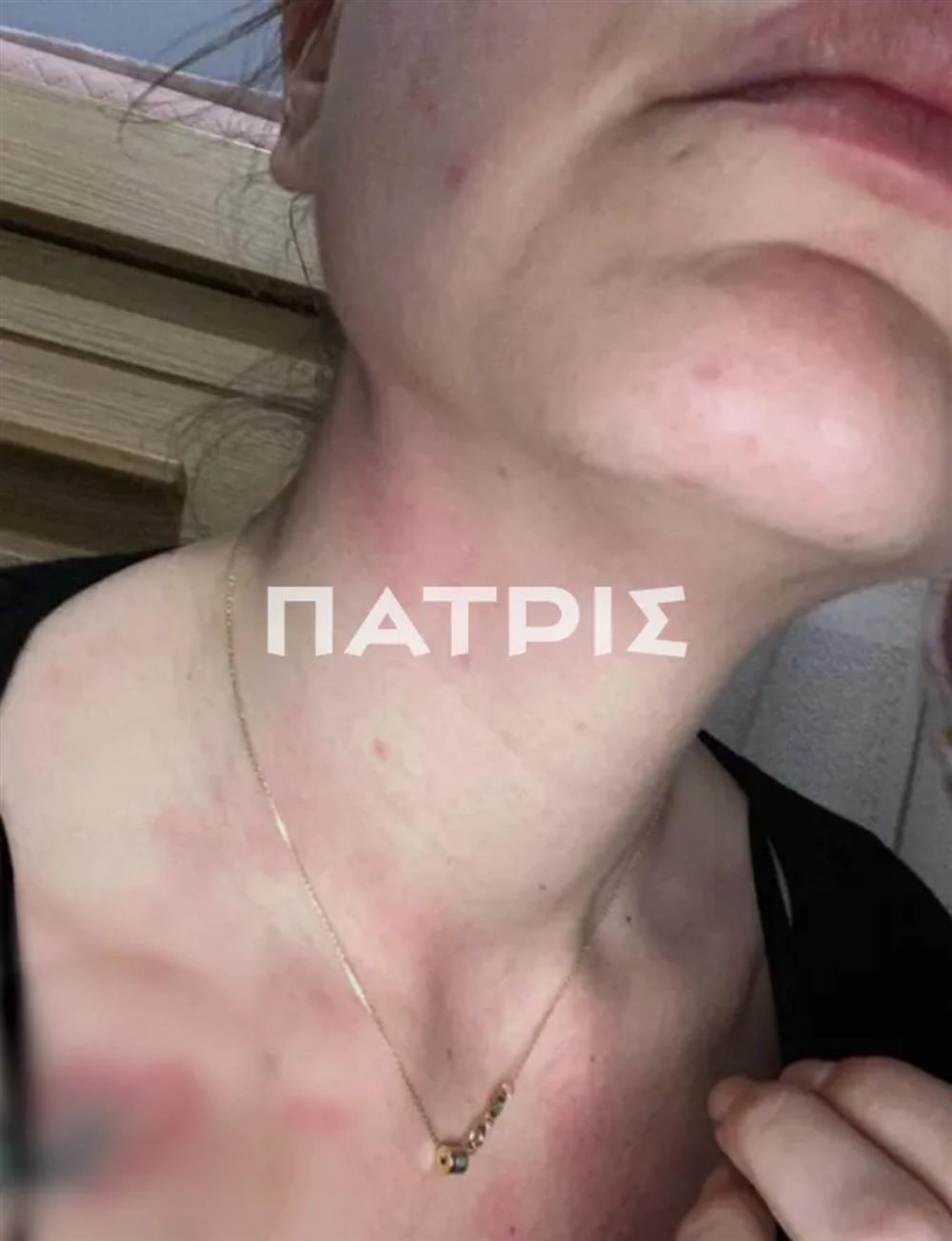 ΚΡΗΤΗ - ΕΝΔΟΟΙΚΟΓΕΝΕΙΑΚΗ ΒΙΑ ΚΡΗΤΗ - ΕΝΔΟΟΙΚΟΓΕΝΕΙΑΚΗ ΒΙΑ