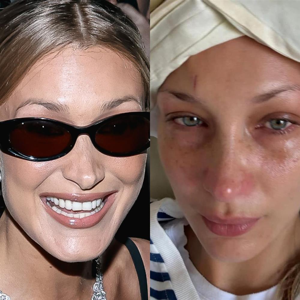 Μπέλα Χαντίντ