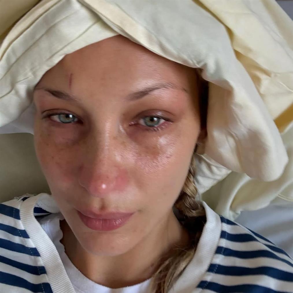 Μπέλα Χαντίντ